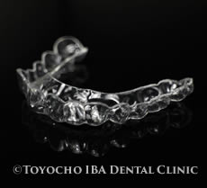 マウスピース治療